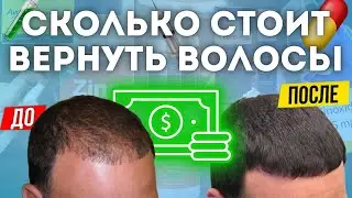 ЦЕНА РАБОТАЮЩЕЙ СХЕМЫ ОТ ОБЛЫСЕНИЯ | ЦЕНА ЛЕЧЕНИЯ ВОЛОС | УХОД ЗА ВОЛОСАМИ