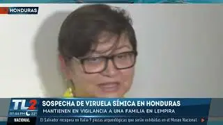 SOSPECHA VIRUELA DEL MONO HONDURAS