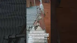 Аппарат внешней фиксации и Илизарова