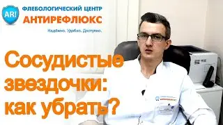 Сосудистые звездочки на теле, как убрать сосудистые сеточки на ногах?
