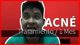 Tratamiento Acné | 1 Mes - Doxiciclina + Experiencia