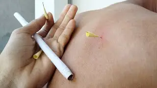 How To Make Paper Blowpipe Arrow Live Experiment On myself ( Don't Try At This Home )
