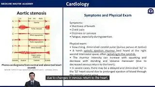 Aortic stenosis with murmurs - USMLE and IFOM