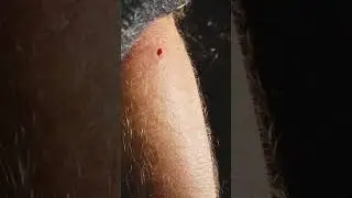 Укус Шершня. Шершни Атакуют мою Руку. Гнездо Шершней !