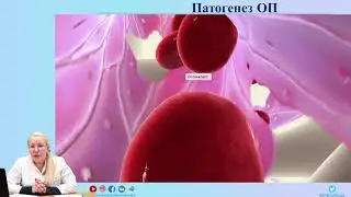 Остеопороз