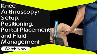 Knee Arthroscopy:  Setup, Positioning, Portal Placement, and Fluid Management