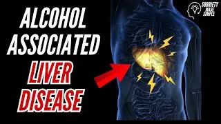 Stop Drinking Alcohol, Alcohol's effects on the liver, Sobriety Made Simple