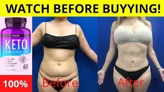 Keto Diet Pills Side Effects | Good or Bad
