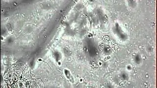 ПКТ отрицательный 5