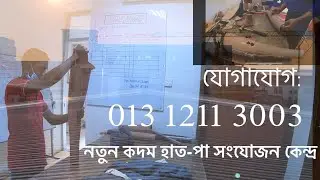 নতুন কদম কৃ্ত্রিম হাত-পা সংযোজন কেন্দ্র |সম্পুর্ন বিনামুল্যে সেবা ।