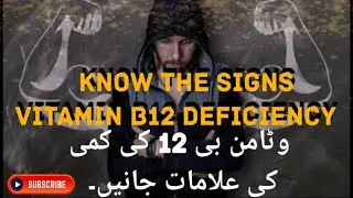 Know the Signs of Vitamin-B12 Deficiency وٹامن بی 12 کی کمی کی علامات جانیں۔