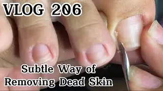 VLOG 206 Satisfying and Relaxing Pedicure: Gentle Removal of Dead Skin and Ingrown #ingrownremoval
