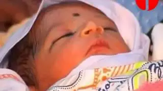 Pakistan 'da 6 Ayaklı Bebek Dünya 'ya Geldi - SIX LEGGED BABY BORN IN PAKISTAN