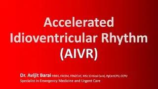 7 things you did not know about the Accelerated Idioventricular Rhythm (AIVR) vs VT
