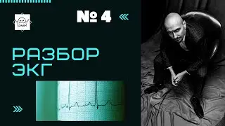 Разбор ЭКГ №4