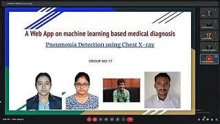 Pneumonia Detection using Chest X-rayby Deep learning