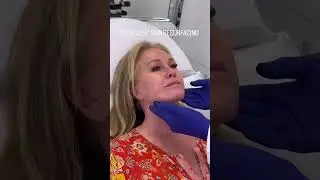 Kathy Hilton's Coolaser® Day
