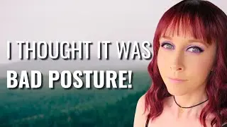Back Pain To RARE CANCER! - Ashley | Adrenocortical Carcinoma | The Patient Story