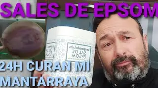 SALES DE EPSOM PROPIEDADES