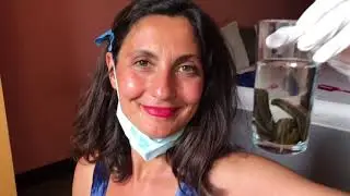 Medicinal Leeches Psoriasis treatment. Лечение Псориазис пиявици хирудотерапия. Пиявки Гирудотерапия