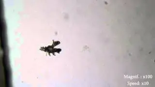 Amoeba Proteus Fortbewegung x10