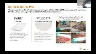 Aroa Biosurgery (ASX: ARX) Presentation, NWR Virtual Healthcare Conference