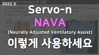 NAVA(Neurally Adjusted Ventilatory Assist) 이렇게 사용하세요 (Servo-n, Servo-i)