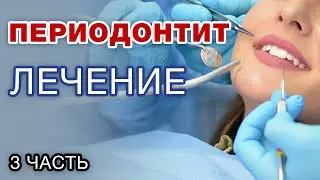 Is Periodontitis Treatment Risky? Can Periodontitis Be Cured? / Part 3
