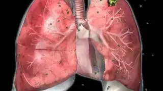How does virus affect human body? (Animation)