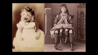 Цирк уродов  истории и трагедии цирковых уродцев