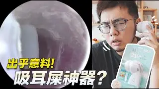 出乎意料！吸耳朵神器？【狸貓】#耳屎