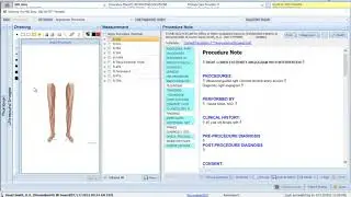 StreamlineMD Procedure Drawing Tool for OBLs and ASCs