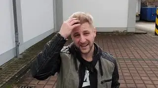 fue hair transplant istanbul result turkey 24 weeks