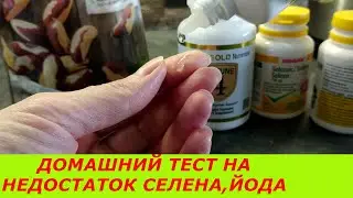 ЕСЛИ ПАЛЬЦЫ ПОБЕЛЕЮТ, ЗНАЧИТ НЕДОСТАТОК СЕЛЕНА , ЙОДА   ЩИТОВИДНАЯ