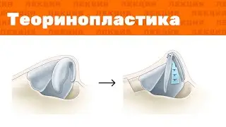 Лекция: «Теоринопластика» (на русском)