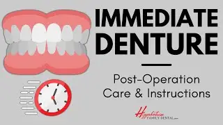 What To Do After Getting an Immediate Denture | #experienceHFD