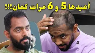 أعيدها 5 و 6 مرات لو عاد بيا الزمن! | تجربتي مع زراعة الشعر