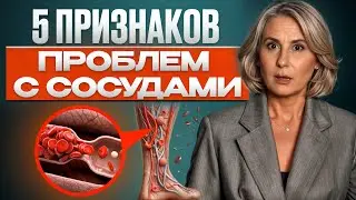 Leg Vessels Are in Danger If You Notice This! / First Symptoms of Clogged Leg Vessels!