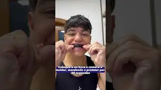 Moldei Meu PROTETOR BUCAL e... 