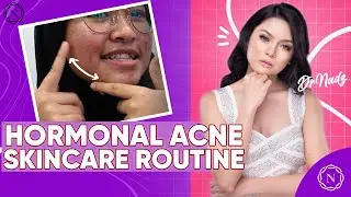 Beauty Tips || HORMONAL ACNE SKINCARE ROUTINE