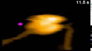 CRISPR-Cas9 in action (high-speed AFM)