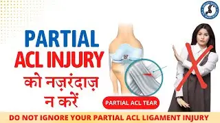 Don't Ignore ACL Partial Injury, partial acl tear, grade 1 acl tear, grade 2 acl tear, acl sprain