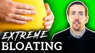 If You Bloat WATCH THIS - Nutritionist Reviews Extreme Bloating (SIBO)