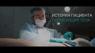 Липосакция тела. История пациента