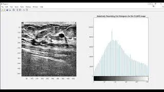 e unet deep reinforcement learning Projects |  Dual Agent DEEP Q Network |  Deep Reinforcement