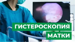 Гистероскопия матки: что это такое, как проводится? Показания к процедуре.