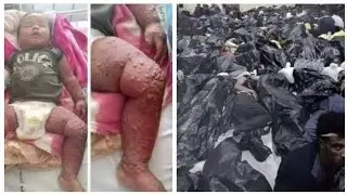 ወደማን ይጮካል አላህ ይገዛችሁ ፈረጃውን ቅርብ ያድርግላችሁ 😥