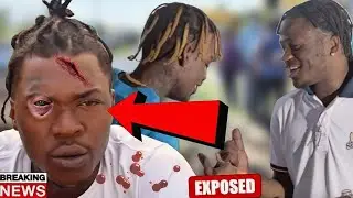 Breaking: Skillibeng & His MANAGER g0t B£@t up In USA / Jahshi Bun 0ut Molly!!! SKENG