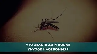 Что делать до и после укусов насекомых?