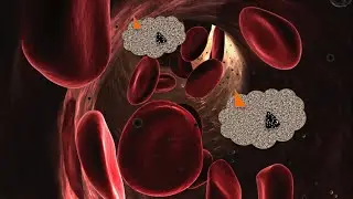 The relevance of CTCs (Circulating Tumour Cells) in the bloodstream - Dr. Fluhrer & Prof. Pachmann